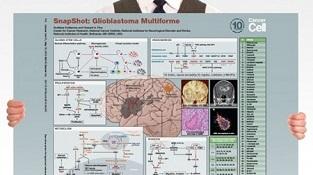 0977-05-02_Glioblastoma_Multiforme.jpg