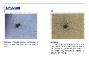 CFC_Assay_Human_sample.jpg