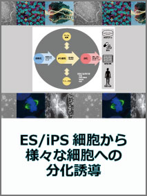 ips-differentiation.jpg