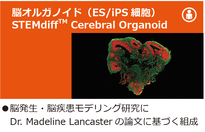 organoid_campaignC.PNG