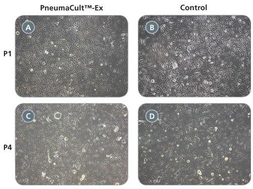 PneumaCult-Ex | 製品情報 | ベリタス
