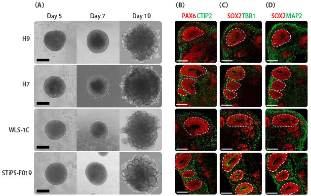 08570Comparison_Cerebdal-Organoid.jpg