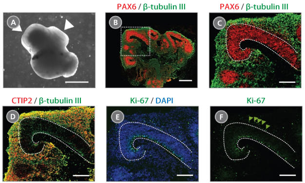 08570STEMdiff_Cerebral_Organoid_Fig1.jpg