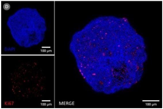 ST-06030_hepaticult_data4.jpg