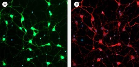 neurofluor_neuo.jpg