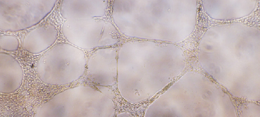 STEMdiff_endothelial_thumbnail.png