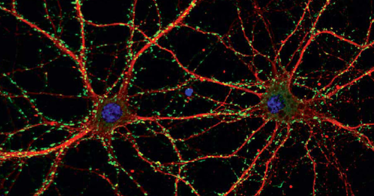 プライマリーニューロンの長期間培養用　無血清サプリメント「NeuroCult SM1」