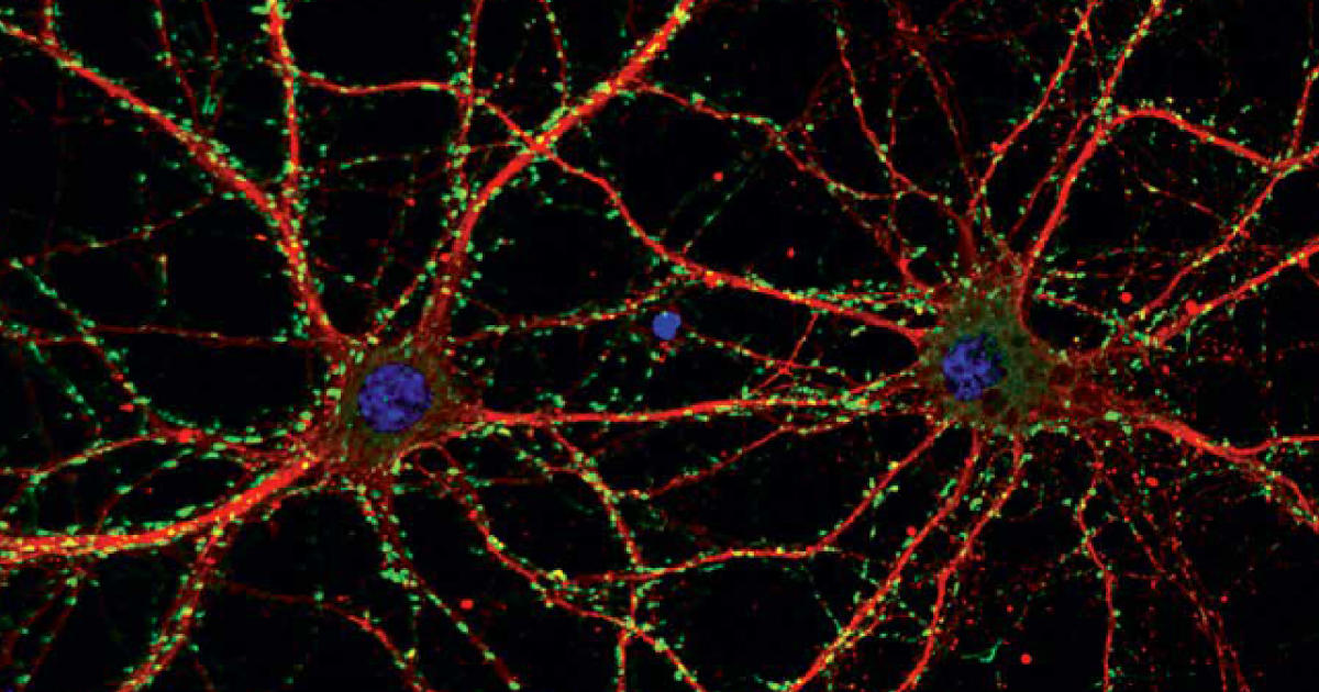 神経研究に役立つ情報、すべてまとめました！（STEMCELL Technologies社）