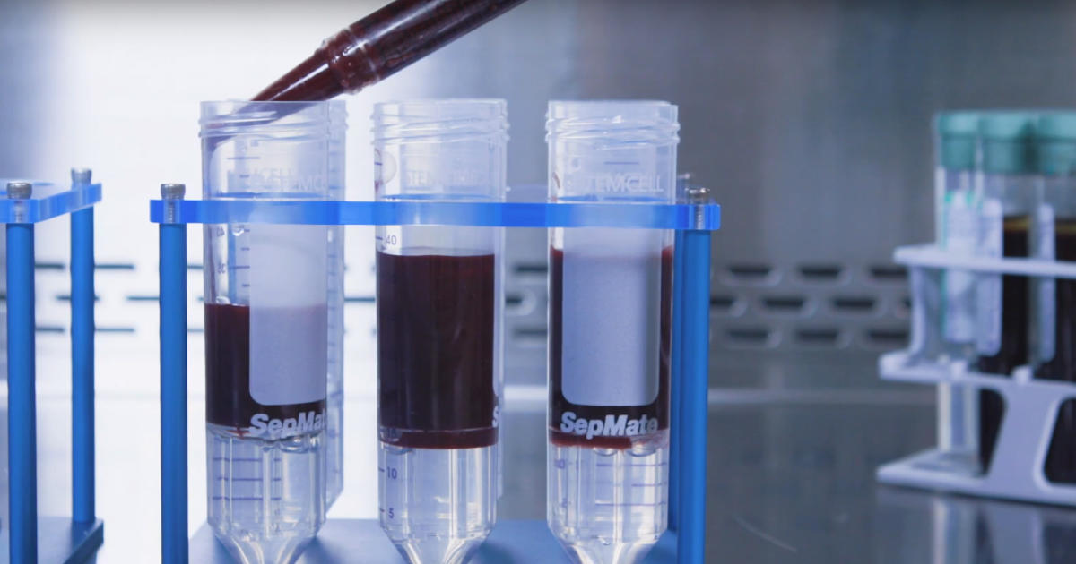 全血からわずか15分でPBMCを調製「SepMate-50」・「SepMate-15」
