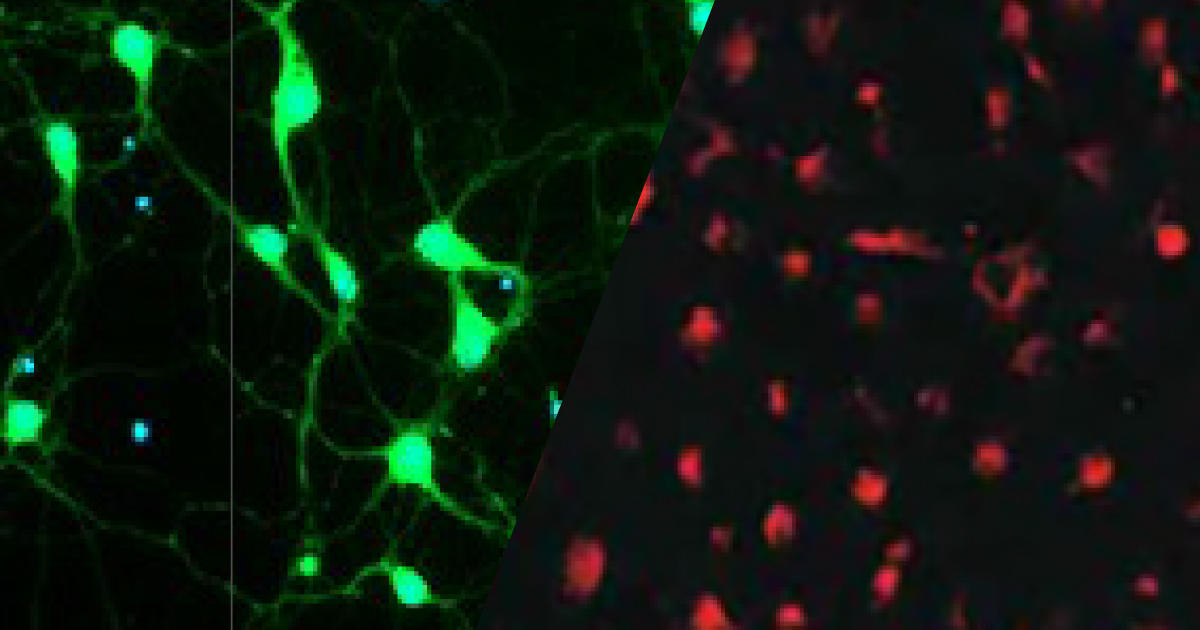 神経細胞を生きたまま標識できる蛍光プローブ　NeuroFluor NeuO