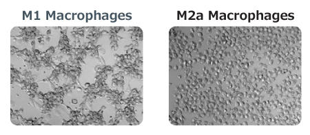 0988_05_Differentiated_macrophages_photo.jpg