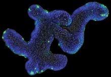 0991_Intestinal_organoid.jpg