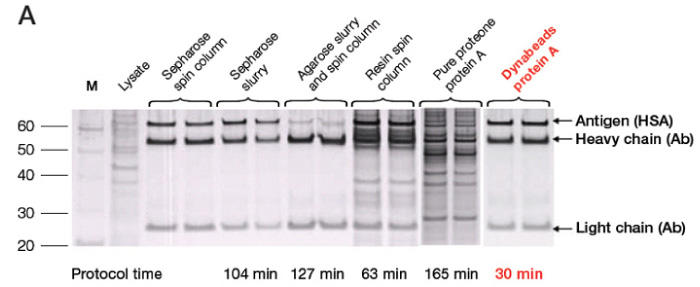 1000_Fig1a_dynabeads_proteina_ip.jpg