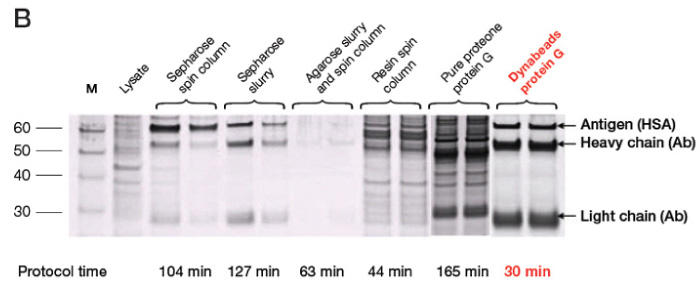 1000_Fig1b_dynabeads_proteing_ip.jpg