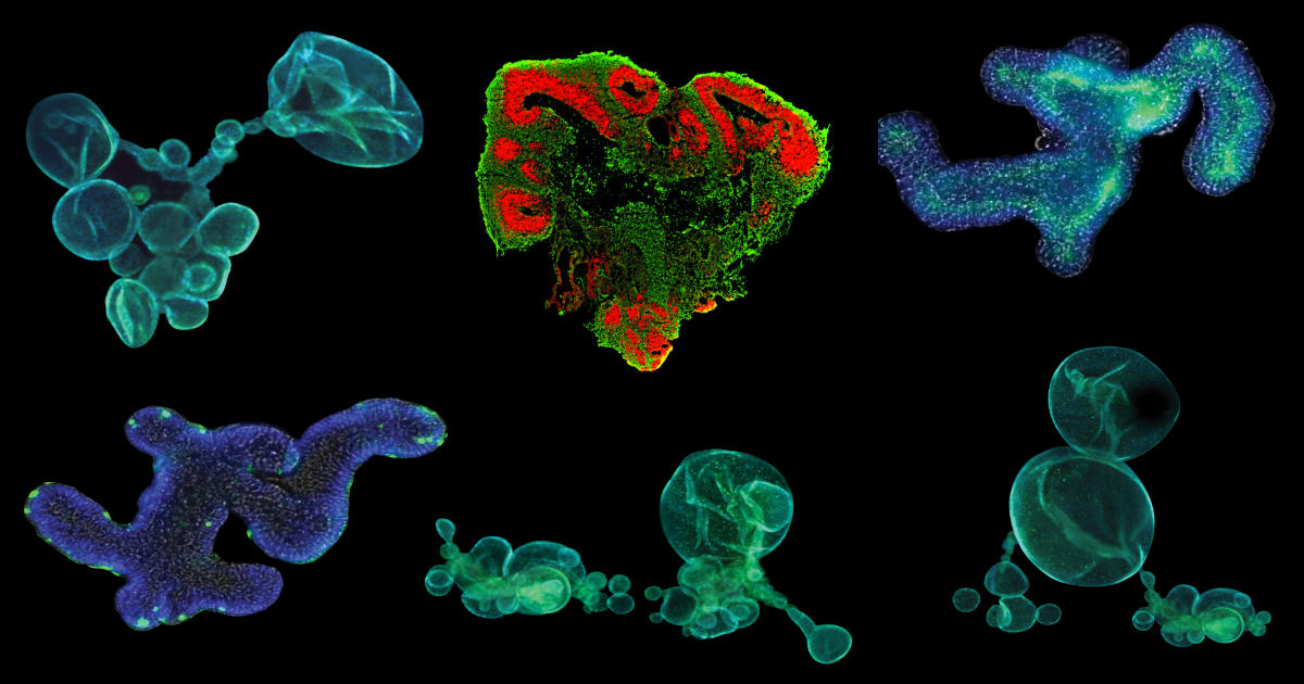 腸管・大脳・肝臓・膵臓・肺・胃・腎臓オルガノイド研究用培地（STEMCELL Technologies社）