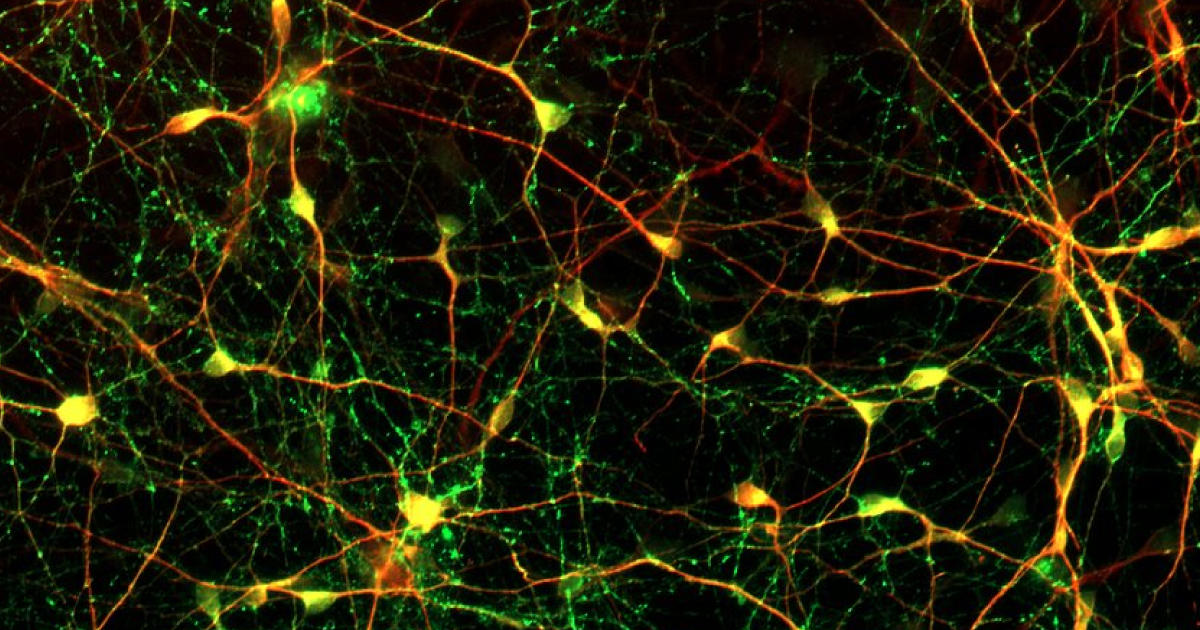 ヒトiPS細胞由来ニューロンと大脳オルガノイドによる神経疾患モデルとは？