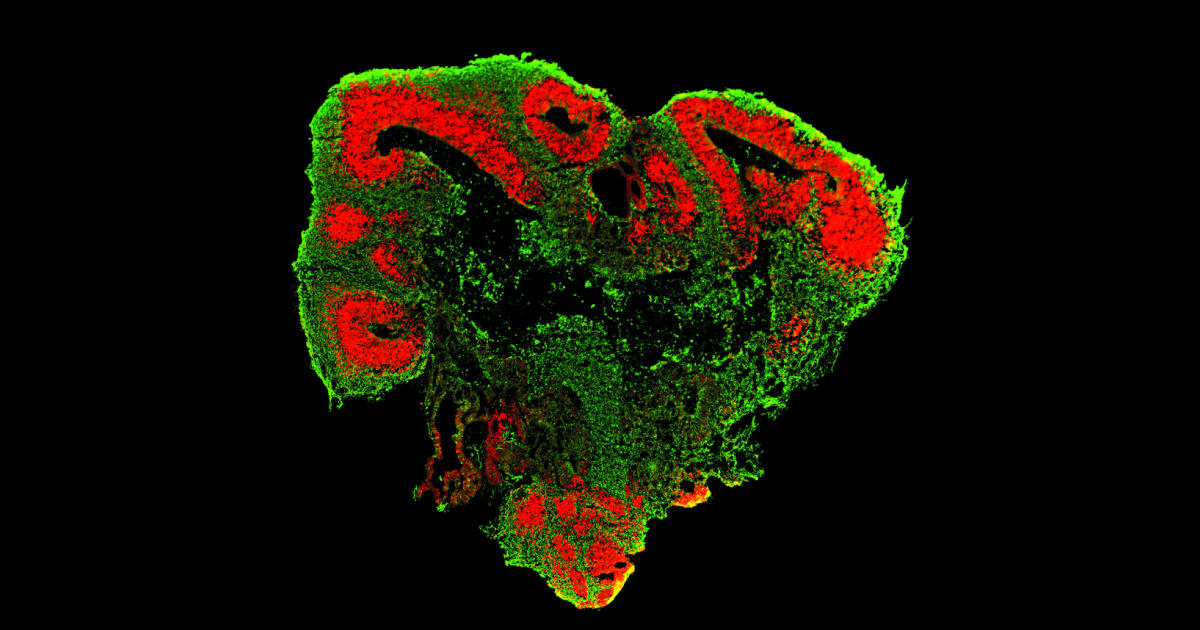 ヒト大脳オルガノイドの培養で確認すべきポイント「STEMdiff Cerebral Organoid」