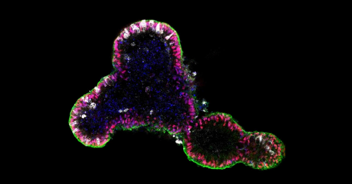 ヒト腸管オルガノイドの樹立および維持培養プロトコール