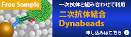 2ndAbDynabeads-sample-banner.jpg