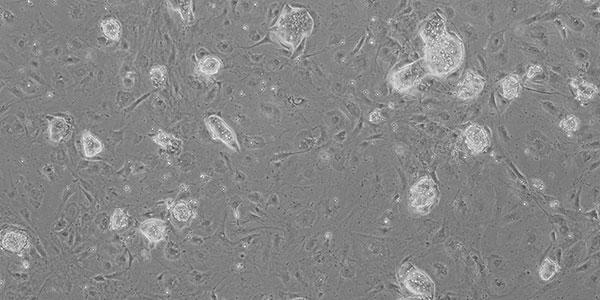 iPS細胞応用研究の進め方 ―維持培養から疾患モデルまで―6.jpg