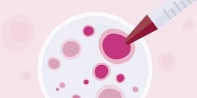 ヒトT細胞増殖プロトコールの最適化：増殖初期での細胞希釈の効果について
