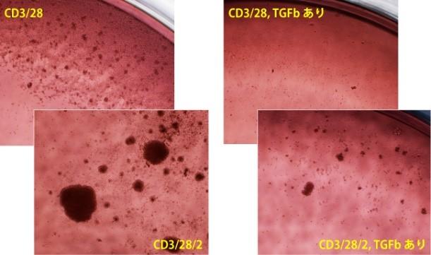 Immunocult 添加時のCD4+T細胞クラスター発達.jpg