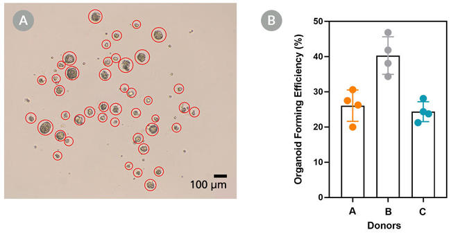 Av-organoid-fig2.jpg