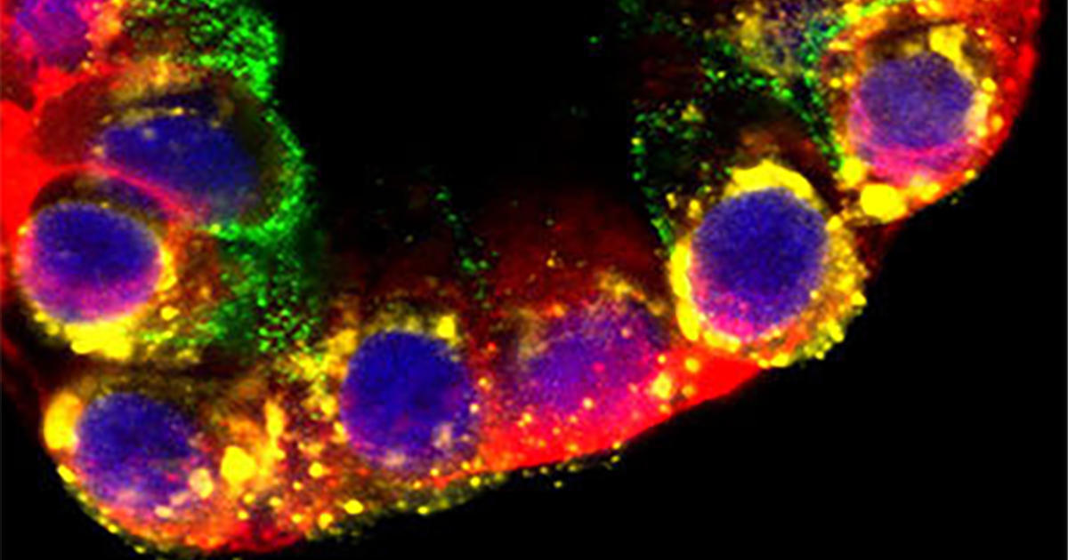 ついにヒト肺胞の<em>in vitro</em>モデルが作製可能に！