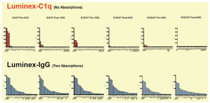 IVIG_monitoring.png