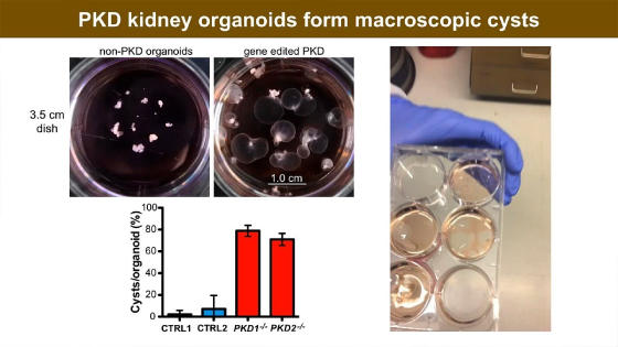 Re-CreatingDiseasewithKidneyOrganoidsandCRISPR-.jpg