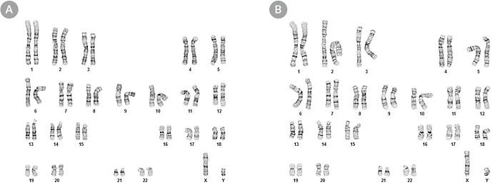 ST-85850_Karyotype.jpg