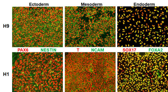 STEMdiff_Trilineage_staining.jpg