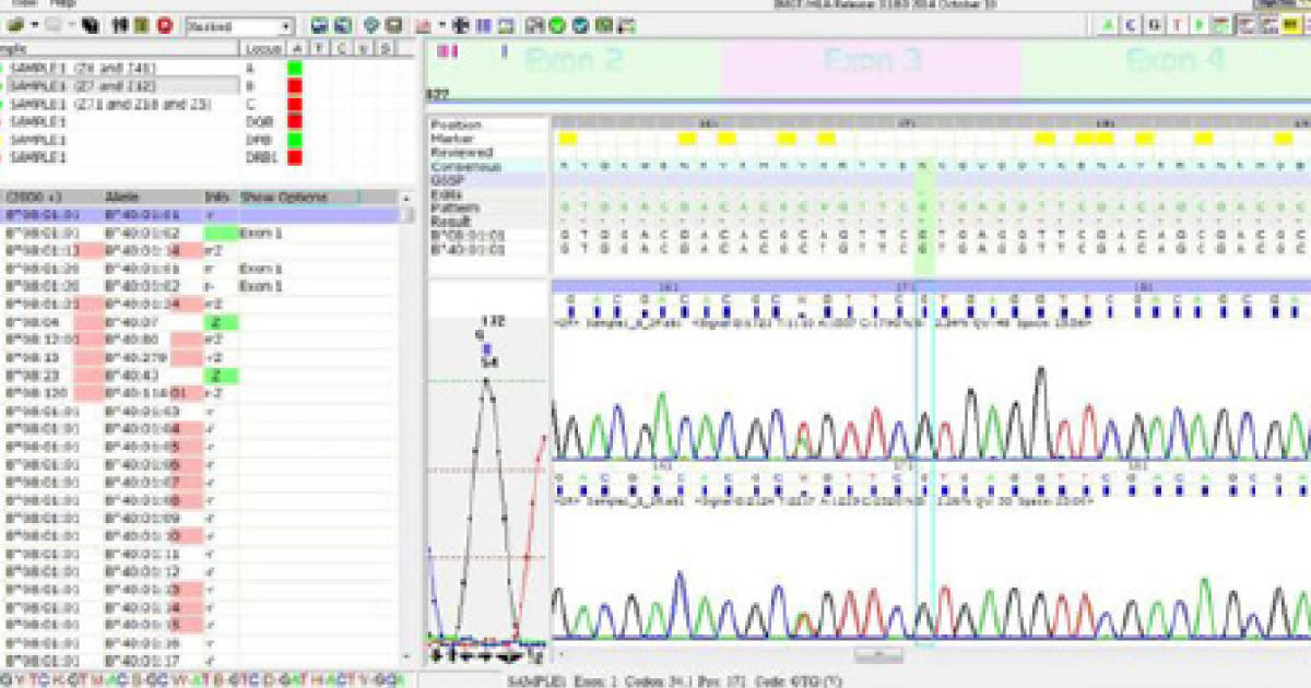 HLA-DNA タイピングキット SeCore SBT