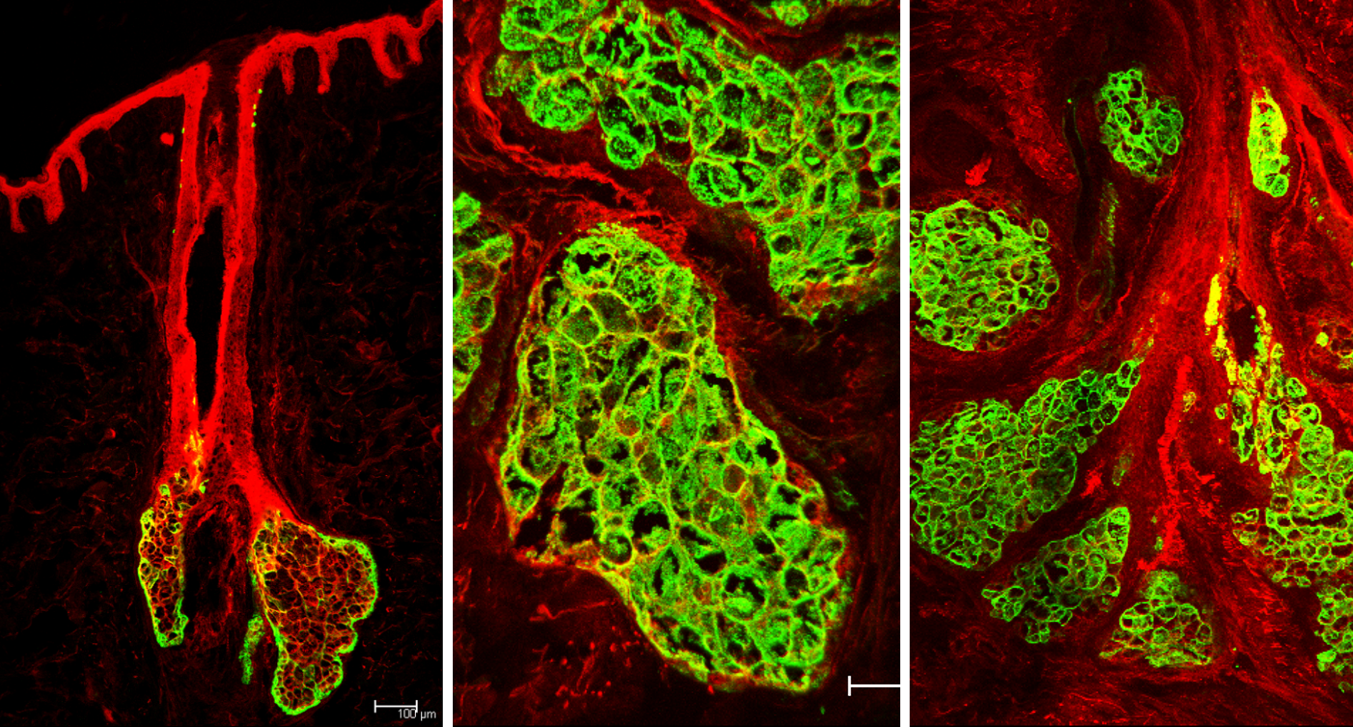 Sebocyte CTI.png