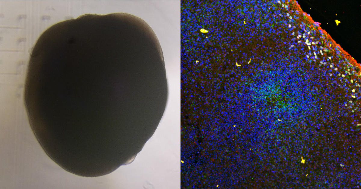 大脳皮質オルガノイドにおける痙攣陽性化合物および抗てんかん薬の応答　研究者の声【27】