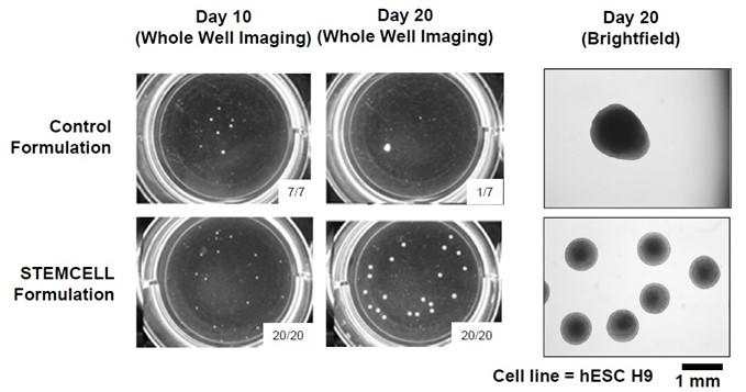 dorsal-ventral-forebrain-organoid3.jpg