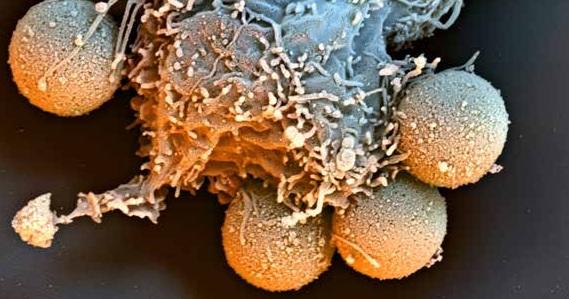 Dynabeads (ダイナビーズ) 磁気ビーズによる分離アプリケーション