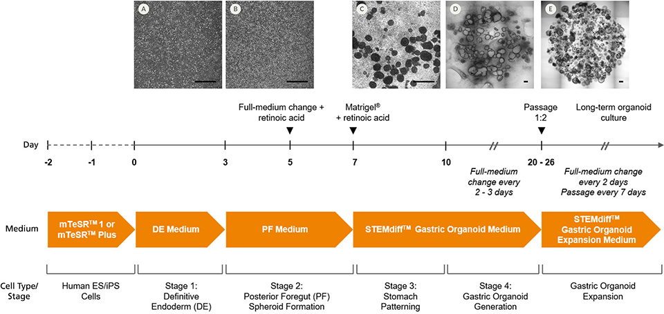 gastric-organoid-1.png