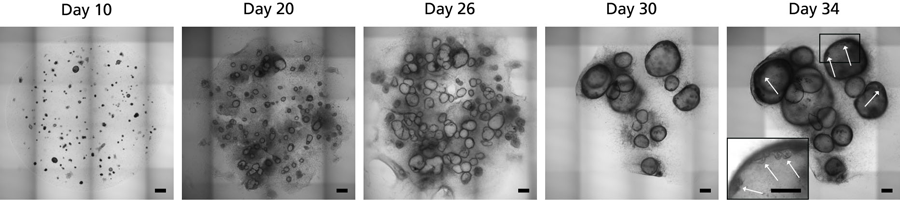 gastric-organoid-3.png