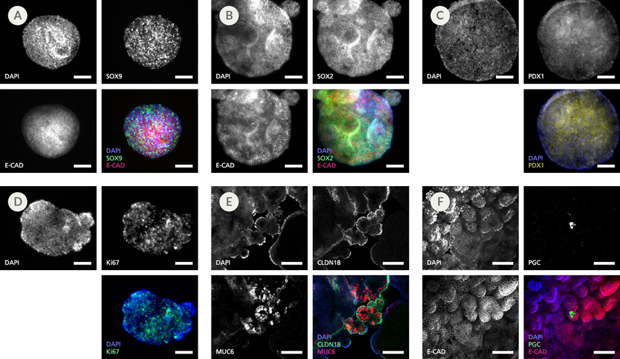 gastric-organoid-6.png