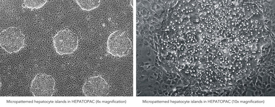 hepatopac-islands.jpg