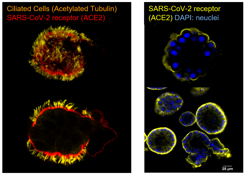 lung_organoid_covid.png