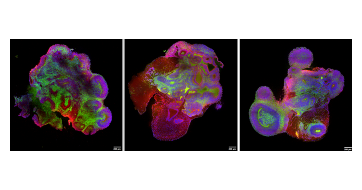 eTeSR培地とSTEMdiff™ Cerebral Organoid Kitを用いた脳オルガノイド作製と高品質3Dイメージング評価 研究者の声【53】