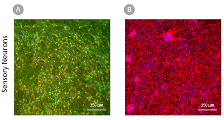 sensory-neuron-fig1L.png