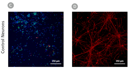 sensory-neuron-fig1R.png