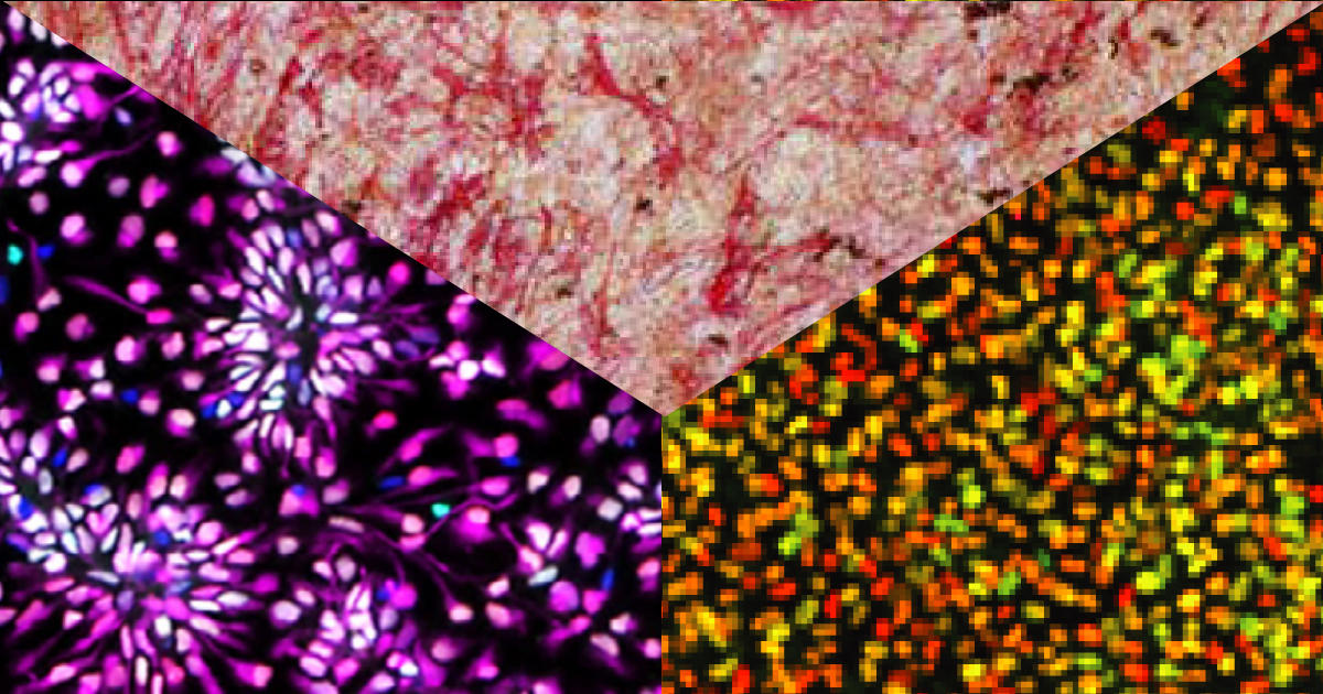 ES/iPS細胞からさまざまな細胞への分化誘導 (STEMCELL Technologies社)