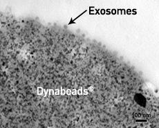 Dynabeads-Exosome.jpg